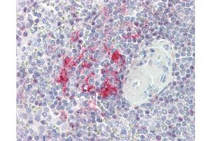 IHC-P Image LITAF antibody [N1C3] detects LITAF protein at cytoplasm on human placenta by immunohistochemical analysis. (LITAF antibody)