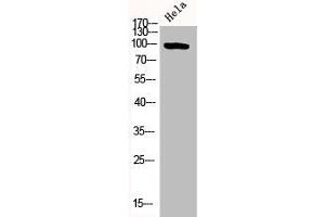 Western Blot analysis of HELA cells using Phospho-PKD2 (S876) Polyclonal Antibody (PKD2 antibody  (pSer876))