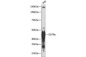Western blot analysis of extracts of Raji cells, using CD79a antibody (ABIN7265805) at 1:1000 dilution. (CD79a antibody)