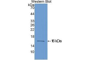 Detection of Recombinant FABP3, Human using Polyclonal Antibody to Heart-type Fatty Acid Binding Protein (H-FABP)