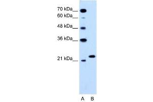 RAB14 antibody (70R-10565) used at 1.