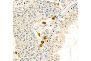 Immunohistochemistry (Paraffin-embedded Sections) (IHC (p)) image for anti-Baculoviral IAP Repeat Containing 3 (BIRC3) antibody (ABIN7073179)