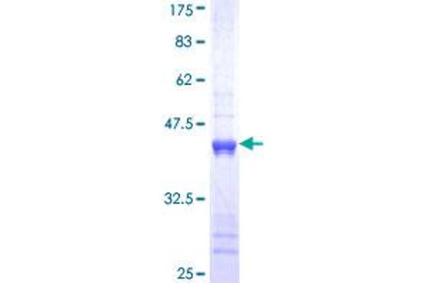 Cytokeratin 1 Protein (AA 387-496) (GST tag)