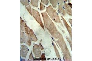 Immunohistochemistry (IHC) image for anti-Creatine Kinase, Muscle (CKM) antibody (ABIN3002974) (CKM antibody)
