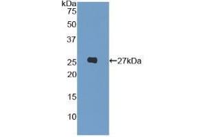 Detection of Recombinant LILRA3, Human using Polyclonal Antibody to Leukocyte Immunoglobulin Like Receptor Subfamily A, Member 3 (LILRA3) (LILRA3 antibody  (AA 219-438))