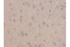 Detection of RBP1 in Rat Cerebrum Tissue using Polyclonal Antibody to Retinol Binding Protein 1, Cellular (RBP1)