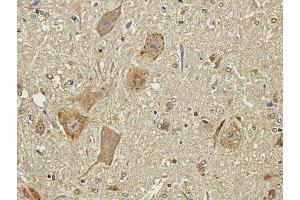 anti-Polysialic Acid antibody