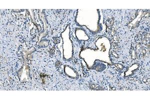 IHC analysis of Carbonic Anhydrase I/CA1 using anti-Carbonic Anhydrase I/CA1 antibody (ABIN7602621).