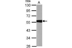 WB Image Sample (30 ug of whole cell lysate) A: A549 10% SDS PAGE antibody diluted at 1:10000 (ALDH1A1 antibody  (C-Term))