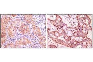 Immunohistochemistry (IHC) image for anti-Synuclein, gamma (Breast Cancer-Specific Protein 1) (SNCG) antibody (ABIN1845097) (SNCG antibody)