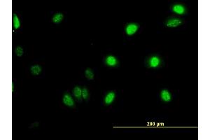 Immunofluorescence of monoclonal antibody to GABPA on HeLa cell. (GABPA antibody  (AA 1-454))