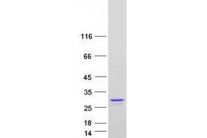 Validation with Western Blot (ARL6 Protein (Transcript Variant 1) (Myc-DYKDDDDK Tag))