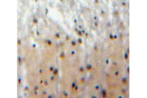Used in DAB staining on fromalin fixed paraffin-embedded brain tissue (FBXW7 antibody  (AA 312-545))