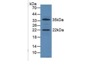 SDS-PAGE of Protein Standard from the Kit  (Highly purified E. (IGF1 ELISA Kit)