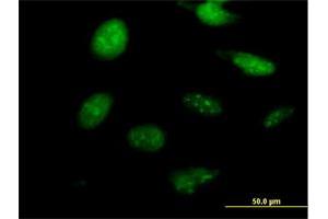 Immunofluorescence of purified MaxPab antibody to NKX2-8 on HeLa cell. (NKX2-8 antibody  (AA 1-239))