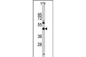 Western blot analysis of TGIF1 polyclonal antibody  in Y-79 cell line lysates (35 ug/lane). (TGIF1 antibody  (Internal Region))