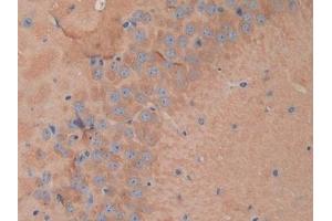 Detection of DNM1 in Mouse Brain Tissue using Polyclonal Antibody to Dynamin 1 (DNM1) (Dynamin 1 antibody  (AA 572-745))