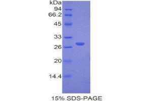 SDS-PAGE (SDS) image for Catechol-O-Methyltransferase (COMT) (AA 63-265) protein (His tag) (ABIN2120753)