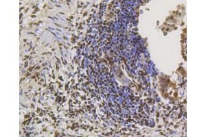 Immunohistochemistry of paraffin-embedded human lung using CREB1 antibody (ABIN4903372) at dilution of 1:100 (40x lens). (CREB1 antibody)