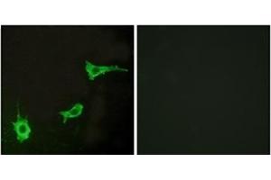 Immunofluorescence analysis of LOVO cells, using EDNRA Antibody . (Endothelin-1 Receptor antibody  (C-Term))