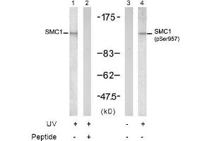 Image no. 2 for anti-Structural Maintenance of Chromosomes 1A (SMC1A) (pSer957) antibody (ABIN196936) (SMC1A antibody  (pSer957))