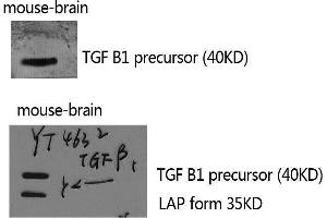 Western Blotting (WB) image for anti-Transforming Growth Factor, beta 1 (TGFB1) (C-Term) antibody (ABIN3187249) (TGFB1 antibody  (C-Term))