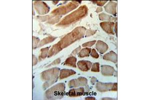 MMAA Antibody IHC analysis in formalin fixed and paraffin embedded human skeletal muscle tissue followed by peroxidase conjugation of the secondary antibody and DAB staining. (MMAA antibody  (N-Term))