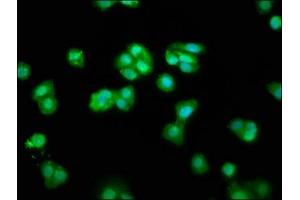 Immunofluorescence staining of HepG2 cells with ABIN7147514 at 1:66, counter-stained with DAPI. (CHMP1A antibody  (AA 1-196))