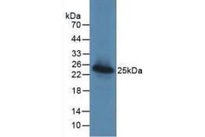 Western Blot; Sample: Recombinant LGALS3BP, Human. (LGALS3BP antibody  (AA 24-221))