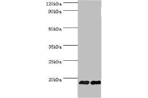 Western blot All lanes: Fibroblast growth factor 1 antibody at 6 μg/mL Lane 1: Mouse kidney tissue Lane 2: Mouse heart tissue Secondary Goat polyclonal to rabbit IgG at 1/10000 dilution Predicted band size: 18, 7 kDa Observed band size: 18 kDa (FGF1 antibody  (AA 16-155))