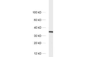 dilution: 1 : 1000, sample: rat brain homogenate (SYPL1 antibody)