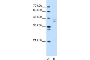 Western Blotting (WB) image for anti-Proteasome (Prosome, Macropain) 26S Subunit, Non-ATPase, 11 (PSMD11) antibody (ABIN2460432) (PSMD11 antibody)