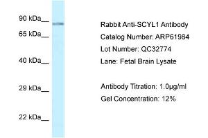 Western Blotting (WB) image for anti-SCY1-Like 1 (SCYL1) (C-Term) antibody (ABIN786532) (SCYL1 antibody  (C-Term))