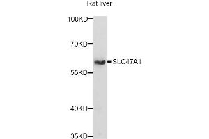 Western blot analysis of extracts of rat liver, using SLC47A1 antibody (ABIN6292279) at 1:1000 dilution. (SLC47A1 antibody)