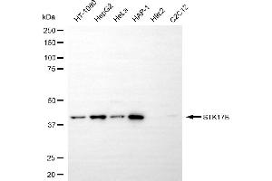 anti-serine/threonine Kinase 17b (STK17B) antibody