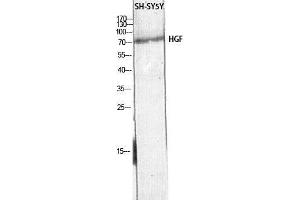 Western Blot (WB) analysis of SH-SY5Y lysis using HGF antibody.