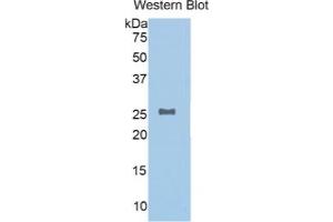 WB of Protein Standard: different control antibodies against Highly purified E.