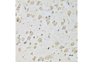 Immunohistochemistry of paraffin-embedded mouse brain using PSMC2 antibody (ABIN5971033) at dilution of 1/100 (40x lens). (PSMC2 antibody)