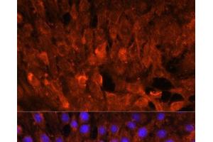 Immunofluorescence analysis of C6 cells using CISH Polyclonal Antibody at dilution of 1:100. (CISH antibody)