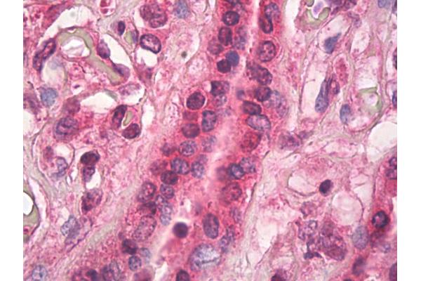 TGM1 antibody