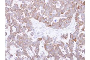 TCP1 theta Antibody staining of paraffin-embedded OVCAR3 xenograft at 1/500 dilution. (CCT8 antibody  (AA 111-327))