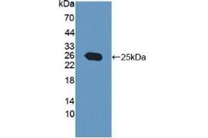 Detection of Recombinant PTP4A3, Human using Polyclonal Antibody to Protein Tyrosine Phosphatase Type IVA 3 (PTP4A3) (PTP4A3 antibody  (AA 1-170))
