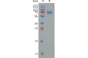 Human BCAM Protein, His Tag on SDS-PAGE under reducing condition.