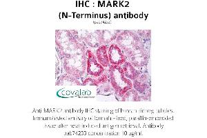Image no. 1 for anti-MAP/microtubule Affinity-Regulating Kinase 2 (MARK2) antibody (ABIN1736766) (MARK2 antibody)