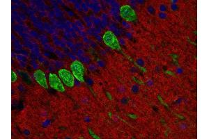 Indirect immunostaining of paraffin embedded mouse cerebellum section with anti-m6A-glycoprotein (dilution 1 : 200; red) and guinea pig anti-calbindin (, dilution 1 : 200; green).