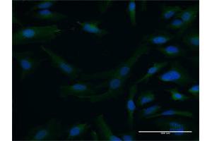 Immunofluorescence of purified MaxPab antibody to DTNA on HeLa cell. (DTNA antibody  (AA 1-371))