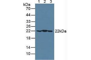 Western blot analysis of (1) Mouse Brain Tissue, (2) Mouse Heart Tissue and (3) Porcine Brain Tissue. (CRYAB antibody  (AA 1-175))