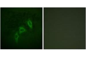 Immunofluorescence analysis of HepG2 cells, using Tuberin/TSC2 (Ab-939) Antibody. (Tuberin antibody  (AA 905-954))