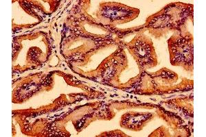 Immunohistochemistry of paraffin-embedded human prostate tissue using ABIN7174184 at dilution of 1:100 (LSM1 antibody  (AA 1-133))