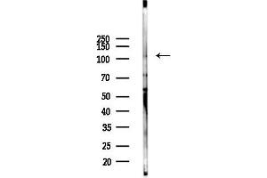 anti-BTB and CNC Homology 1, Basic Leucine Zipper Transcription Factor 1 (BACH1) (Internal Region) antibody